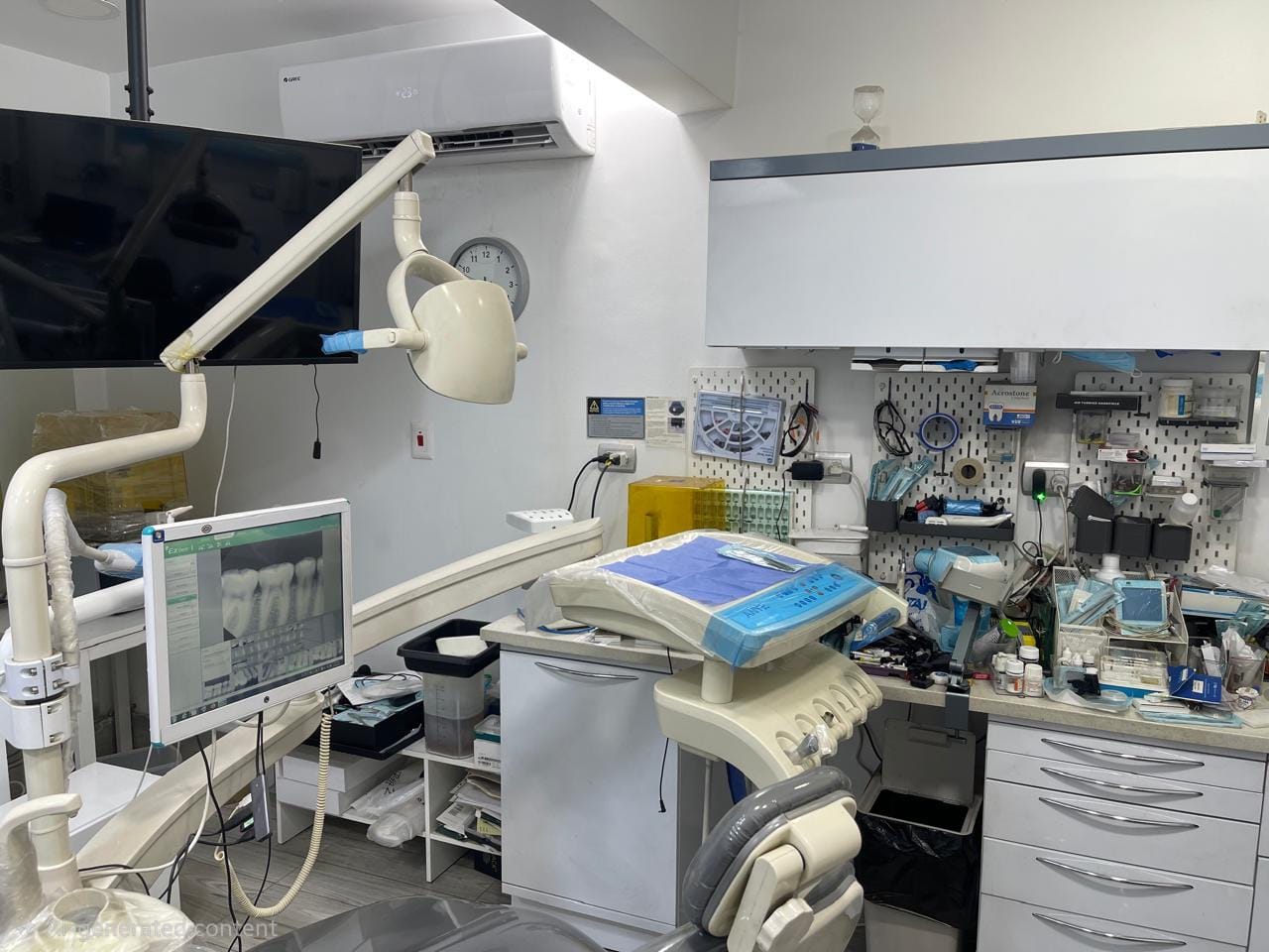 Modern treatment room at Prime Dental Clinic with dental chair and monitor